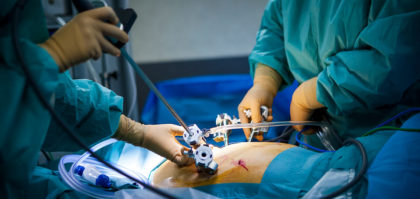 Hysterectomy vs open surgery critical review