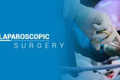 Laparoscopy - gynaecological laparoscopic procedure